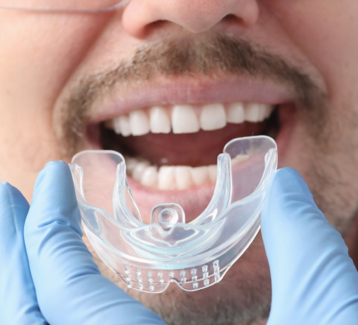 Sports Mouthguard